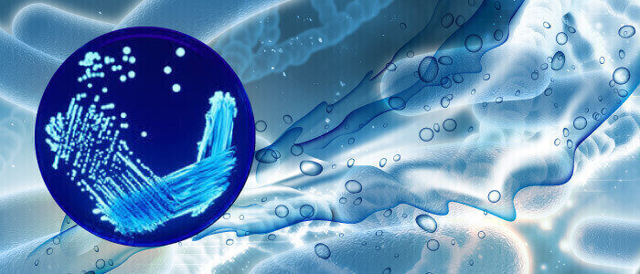 legionella